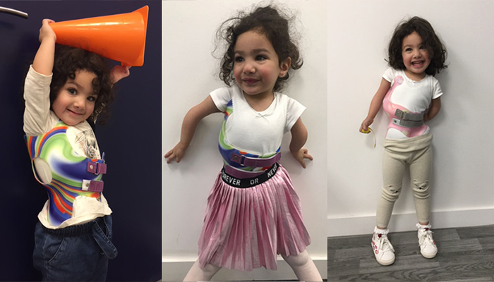 One of our juvenile scoliosis patients was two years old when we first braced her. Her primary curve reduced from 44 to 27 degrees in 4 months. From left: first brace fitting, review of first brace and second brace fitting.