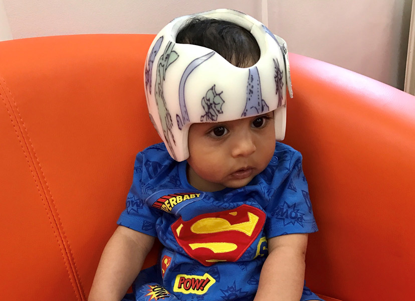 Above: Baby Amrit receives has his bespoke cranial orthosis, or helmet, fitted with dinosaurs