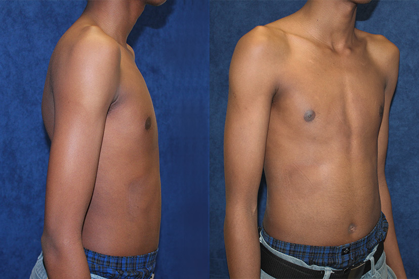 Above: After treatment