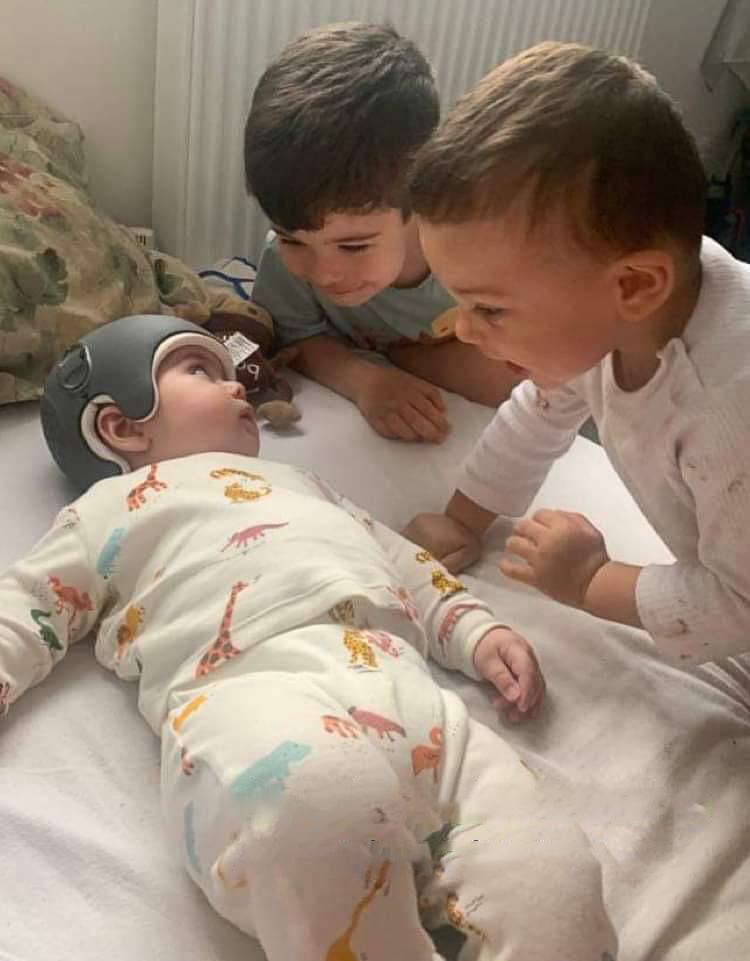 Baby Iyad wearing the London Orthotic Consultancy LOCband Lite helmet and his brothers seeing him for the first time