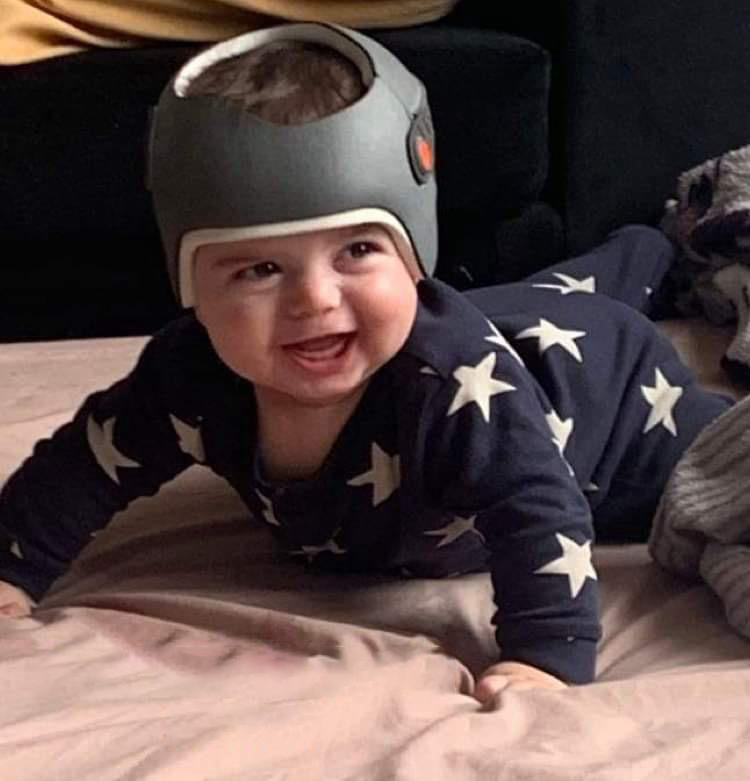 Baby Iyad in the LOCband Lite helmet
