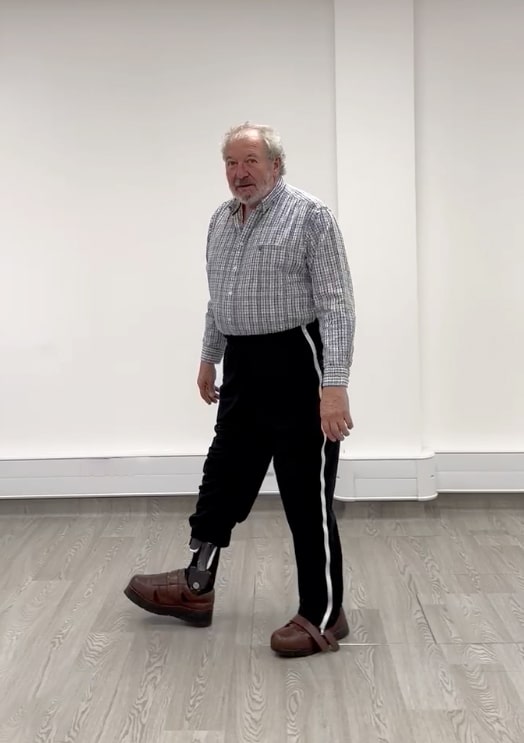 Patient wearing a bespoke carbon fibre ankle foot orthosis after missing part of his ankle due to a catastrophic motor bike accident