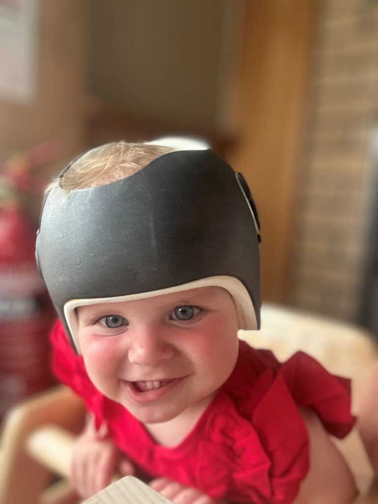 Lexie smiling wearing a black and white cranial helmet, dressed in a red outfit.
