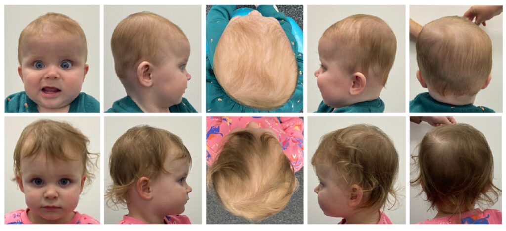 Before and after shots of Lexie